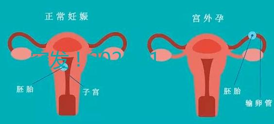突發！2024.11.15，天津試管嬰兒納入醫保報銷（附14家醫保定點醫院）