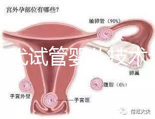 第一代試管嬰兒技術全解析：流程、適應癥及優缺點指南