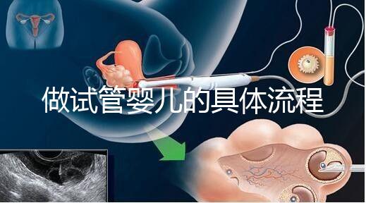 做試管嬰兒的具體流程