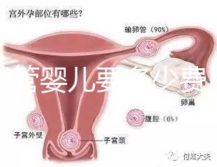 做試管嬰兒要多少費(fèi)用（做試管嬰兒要多少費(fèi)用？）