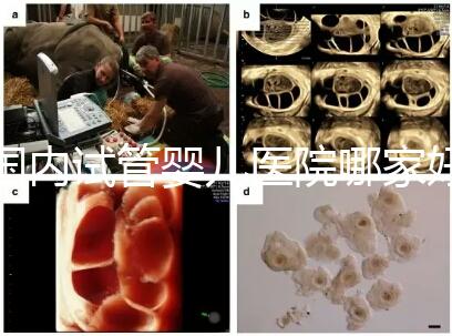 國內試管嬰兒醫(yī)院哪家好？慈銘博鰲深受患者信賴