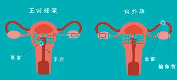 人保試管嬰兒保險哪里能買、怎么買速覽，一篇看懂不踩坑