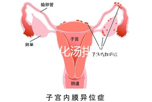 產后喝生化湯排惡露會使寶寶拉肚子？醫生：時間沒用對