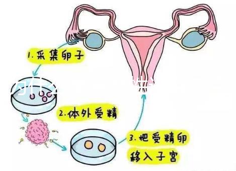 為什么單身女性選擇烏克蘭MINI醫院試管嬰兒？詳細分析三個原因