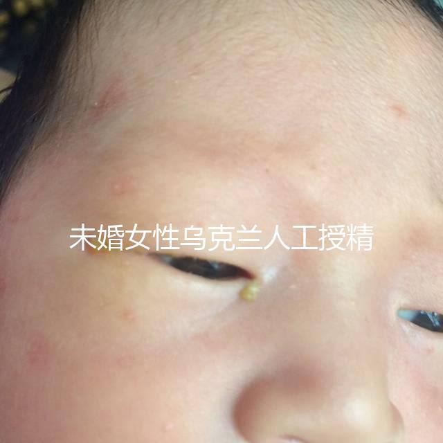 未婚女性烏克蘭人工授精必看！醫(yī)療及生活費(fèi)用明細(xì)預(yù)覽