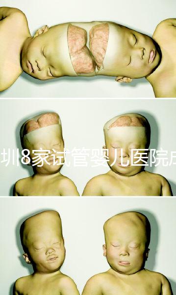 深圳8家試管嬰兒醫(yī)院成功率排名，供卵、供精首選各不同