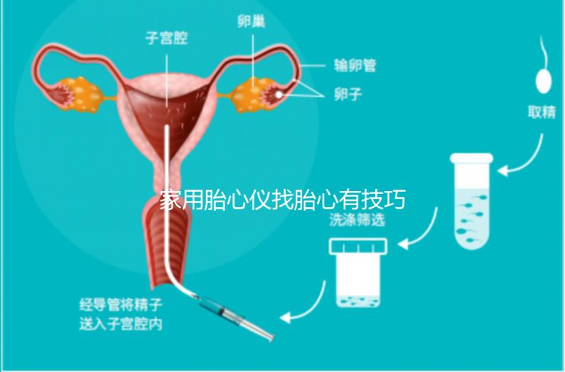 家用胎心儀找胎心有技巧，飯后半個小時測準(zhǔn)確率稍高