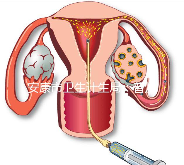 安康市衛(wèi)生計(jì)生局：普及優(yōu)生優(yōu)育五項(xiàng)檢查相關(guān)知識(shí)