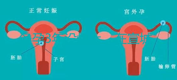 備孕3年沒懷上，在宣城可以做試管嬰兒嗎？