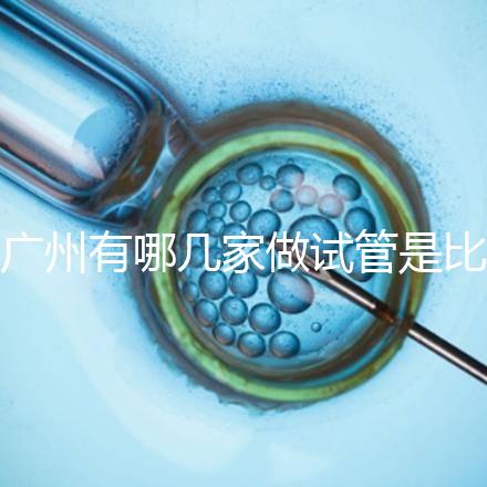 廣州有哪幾家做試管是比較靠譜的，最近有打算？