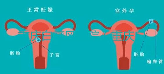 重慶白癜風(fēng)醫(yī)院（重慶白癜風(fēng)專科醫(yī)院在哪里）