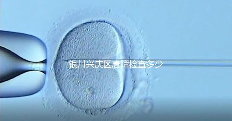 銀川興慶區(qū)唐篩檢查多少錢取決于情況，2024年國(guó)家免費(fèi)限額