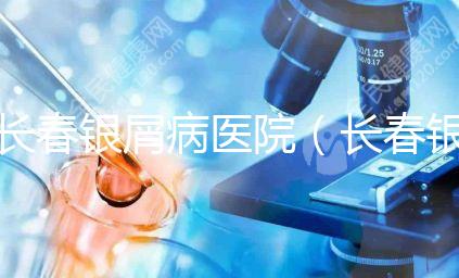 長春銀屑病醫院（長春銀屑病醫院哪個最好）