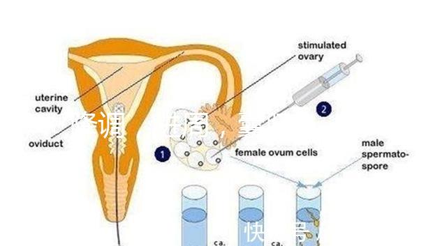 降調，進周，囊胚……這些試管嬰兒助孕術語你都懂嗎？