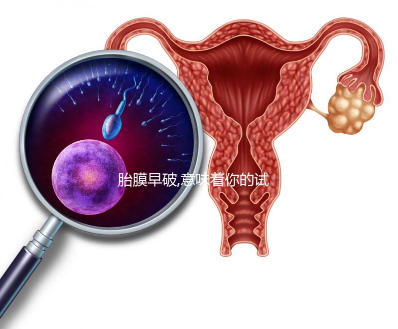 胎膜早破,意味著你的試管嬰兒媽媽夢也破裂了?!