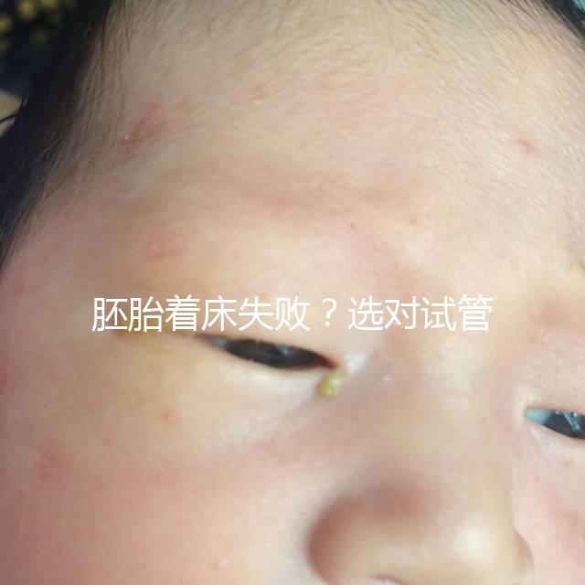 胚胎著床失敗？選對試管嬰兒醫(yī)生很重要