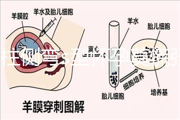 脊柱側(cè)彎s型懷孕莫慌張,能否順產(chǎn)還得看這4大要素