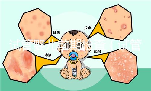 試管嬰兒前期檢查(試管嬰兒前期檢查項(xiàng)目和流程)