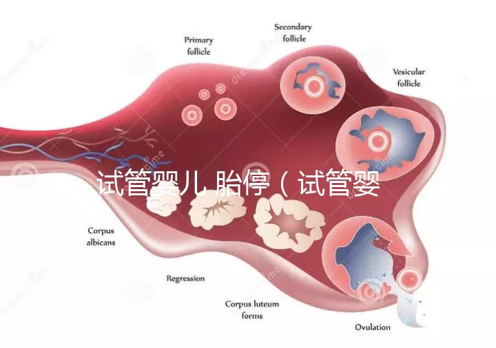 試管嬰兒 胎停(試管嬰兒胎停是什么原因引起的)