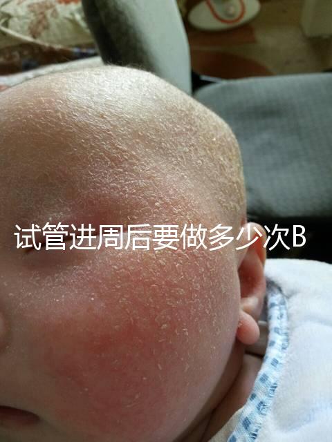 試管進(jìn)周后要做多少次B超？需要檢查什么？進(jìn)來看看