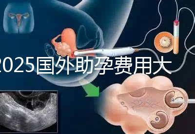 2025國(guó)外助孕費(fèi)用大公開(kāi)：?jiǎn)紊砣耸抠M(fèi)用對(duì)比與機(jī)構(gòu)推薦