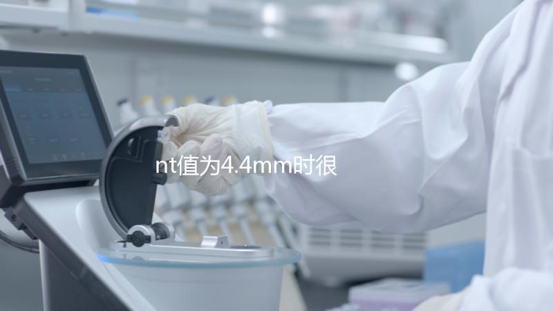 nt值為4.4mm時(shí)很危險(xiǎn)，及時(shí)羊穿確認(rèn)胎兒畸形很重要